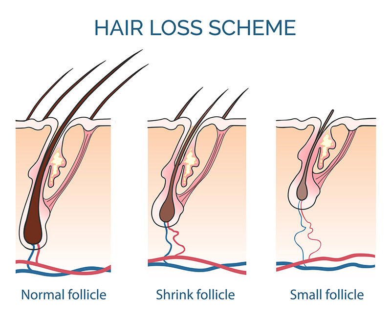 Efectul “dose-dependent” al cistinei in tratamentul alopeciei