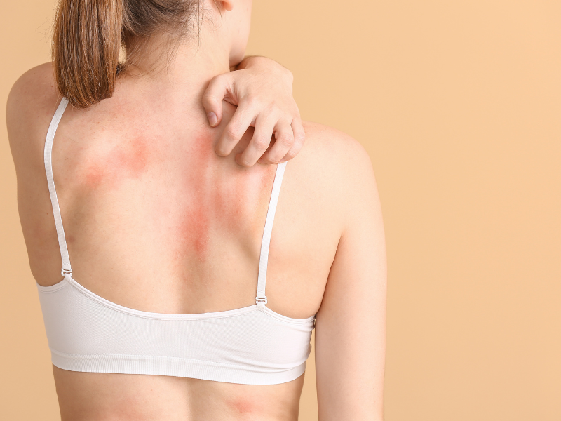 Pielea Care Te Mână la Disperare: De la Mâncărime la Remedii