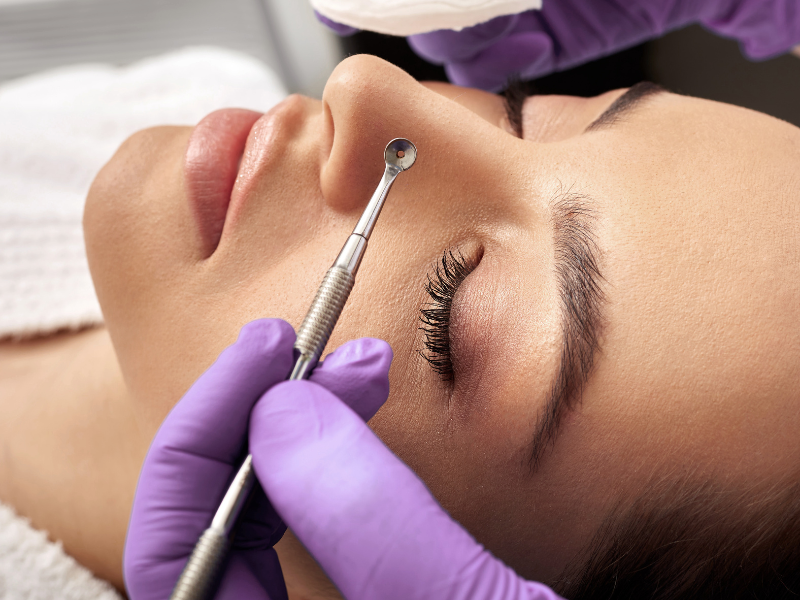 Prevenirea Punctelor Negre Prin Produse Bogate în Antioxidanți